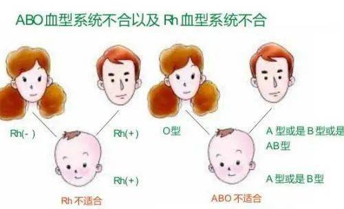 a型b型o型_o型血和a型血生的孩子会黄疸吗_o型和b型生的孩子是a型